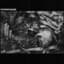 Terminal Wound