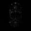 Imminence