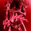 Carnage