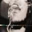 Ziggy Marley & The Melody Makers